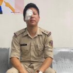 Brave Cop Injured in Bandh Violence: SI Tamo Bakhang Faces Possible Vision Loss After Stone-Pelting Attack